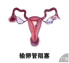 输卵管性不孕出现的危害有什么