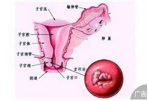 哪家医院治疗阴道肿瘤比较好