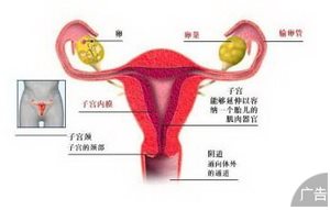 女性得了卵巢囊肿如何是好?