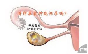 治疗卵巢囊肿比较好的医院