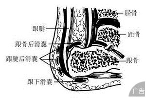 滑囊炎不及时治疗有哪些后果