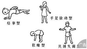 脑瘫的原因