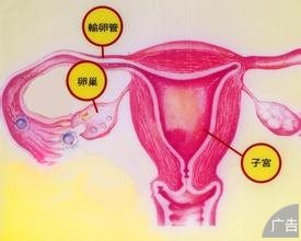卵巢肿瘤是如何造成女性不孕的?