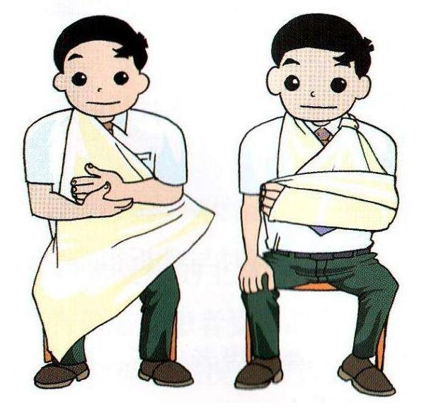 上肢骨折