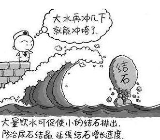 肾结石