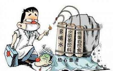 尿道结石