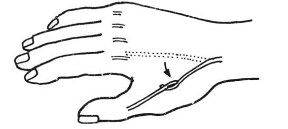 1596791940721368.jpg 10-1F106104453415.jpg