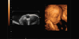 1603955932275163.gif 微信图片_20201029145139.gif